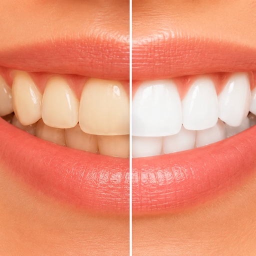 Crest 3D White Whitestrips - Professional White